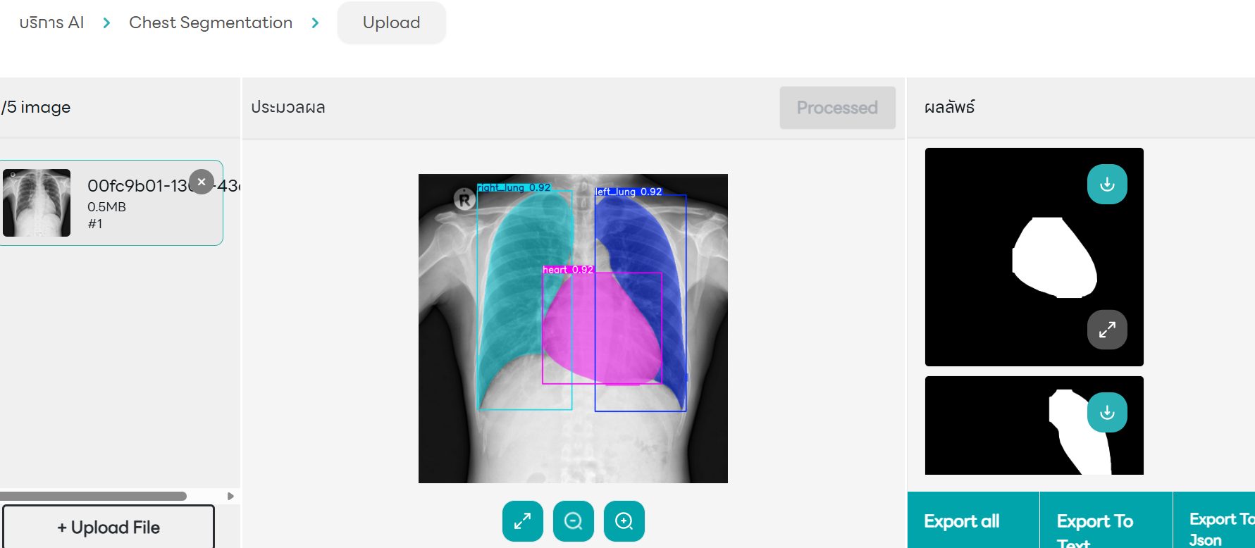 Medical AI Service 1 -- Segmentation